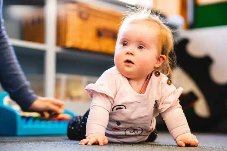 Baby with Down syndrome crawling during pediatric therapy session, developing motor skills through early intervention.